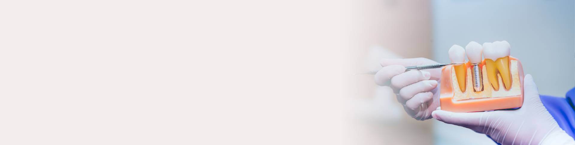 banner banner