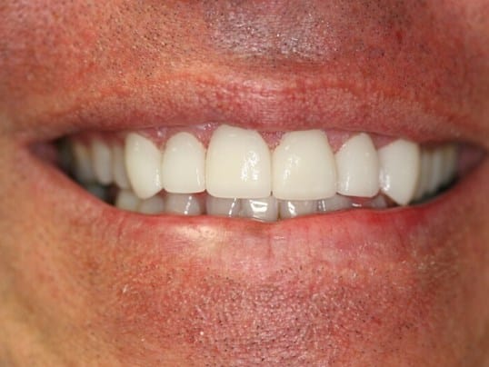 Smile Improvement before treatment
