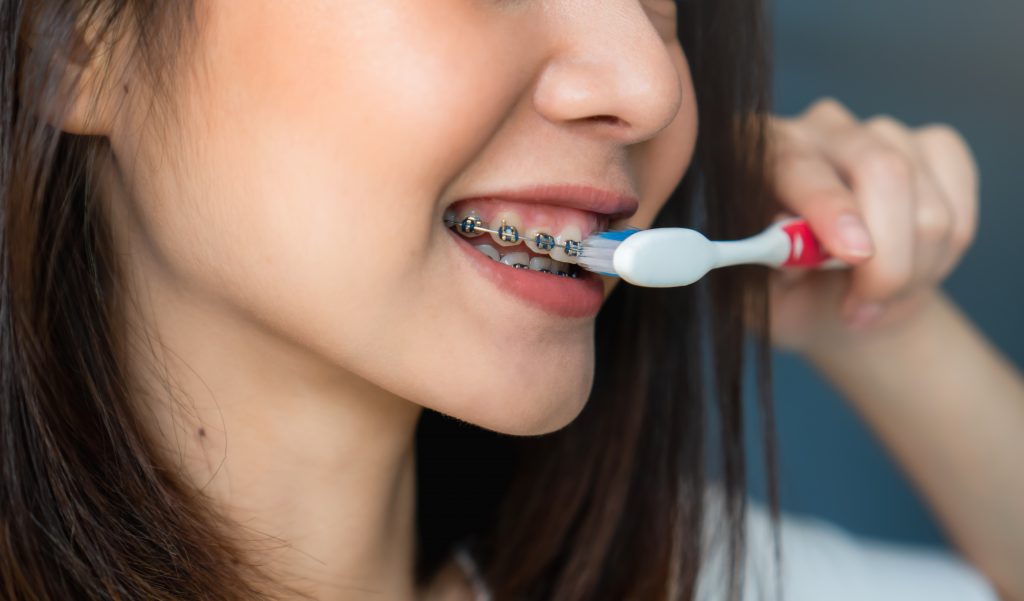 Braces, Illness & Special Cases