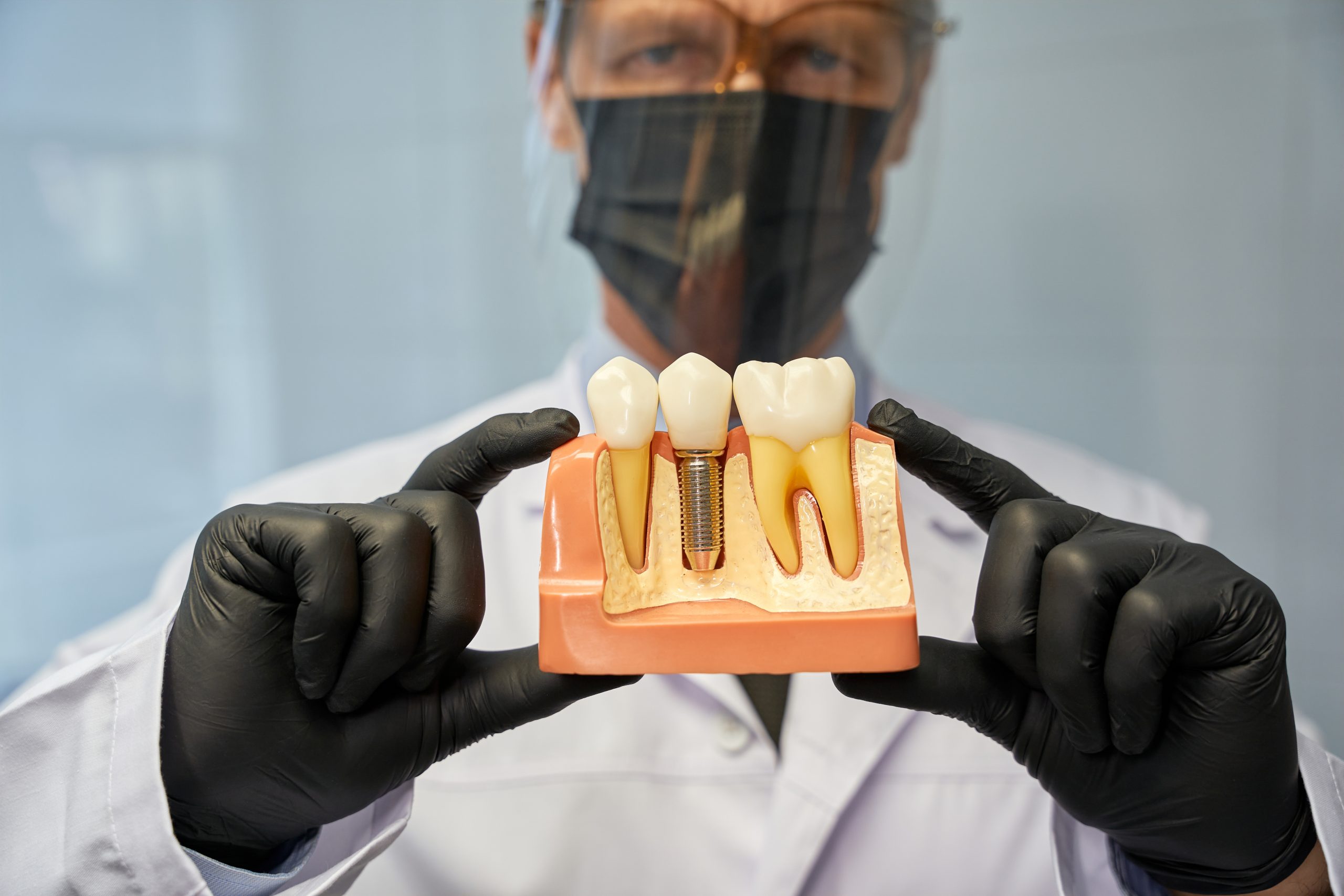 Types of Dental Bridges