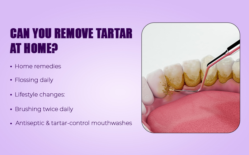 Remove Tartar at Home