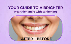 Teeth whitening at the dentist