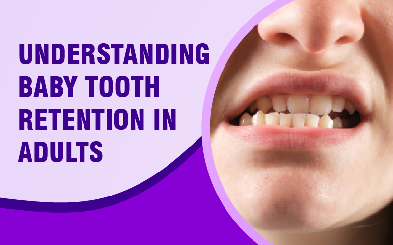 I’m an Adult, But I still Have One Baby Tooth