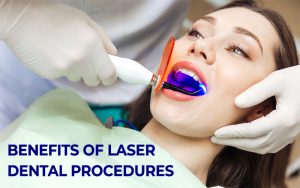Benefits of Laser Dental Procedures