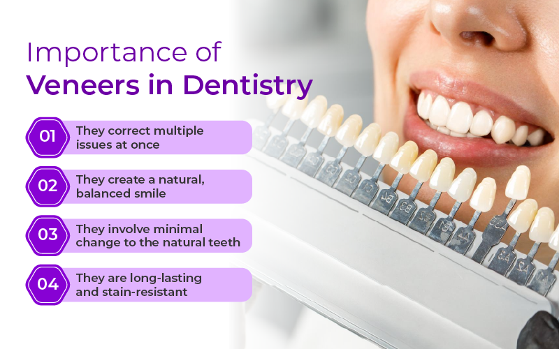 Importance of veeners in dentistry