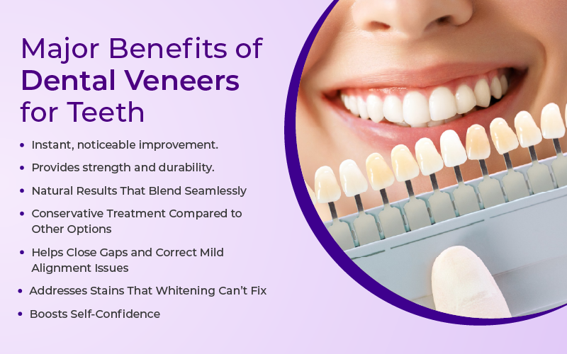 Major Benefits of Dental Veneers for Teeth