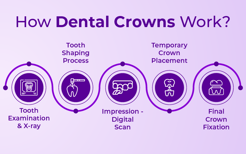 How Dental Crowns Work?