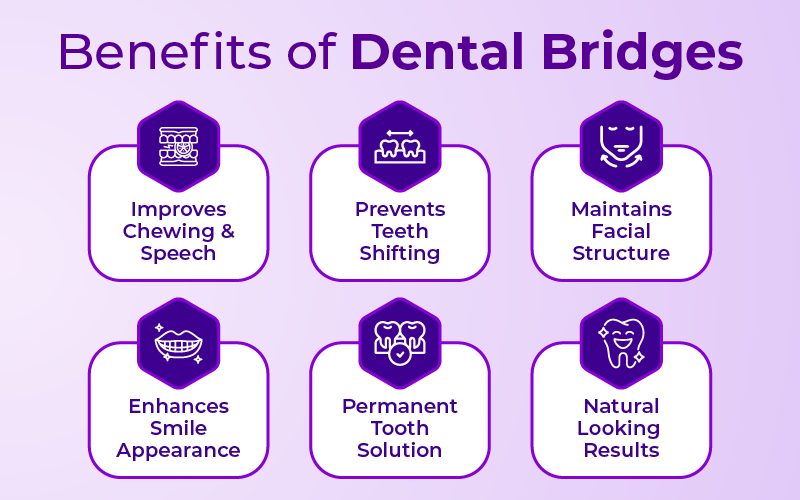 Benefits of Dental Bridges