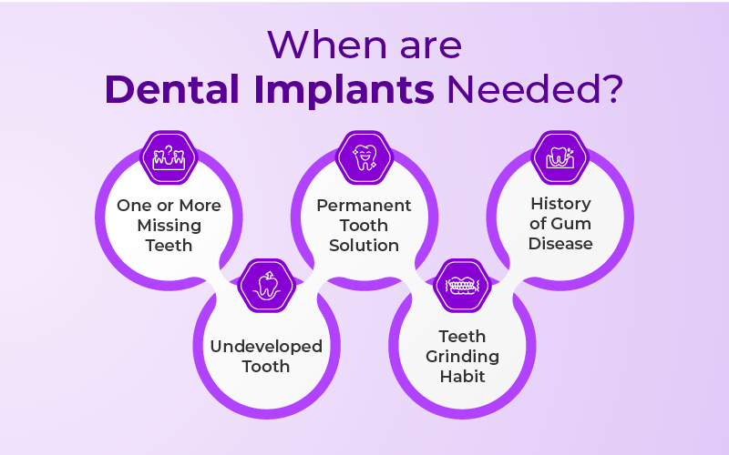 When are Dental Implants Needed?