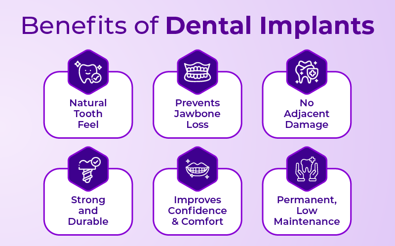 Benefits of Dental Implants