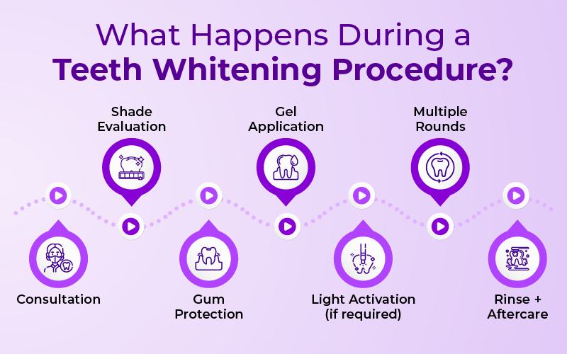 What happens during a Teeth Whitening Procedure?