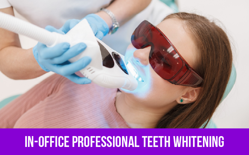 In Office Teeth Whitening