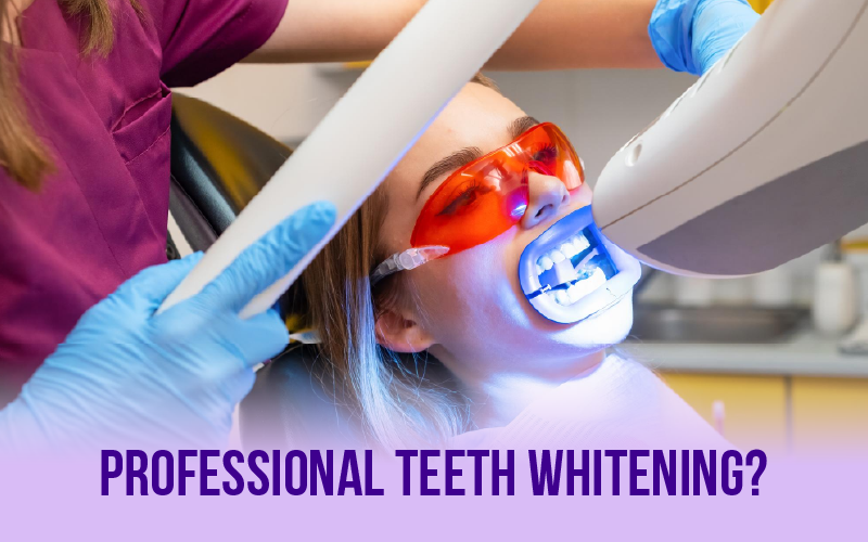 What is Professional Teeth Whitening?