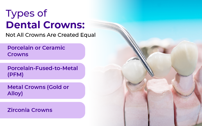 Types of Dental Crowns: Not All Crowns Are Created Equal