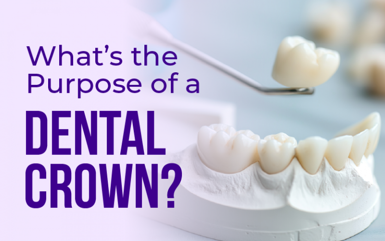 What’s the Purpose of a Dental Crown?