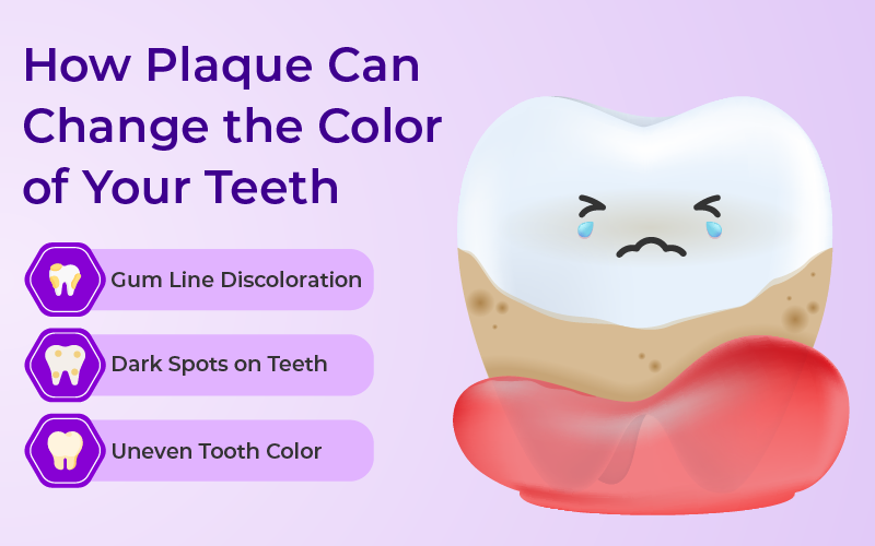 Does Plaque Really Affect the Color of Your Teeth?