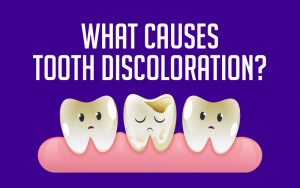 What Causes Tooth Discoloration?