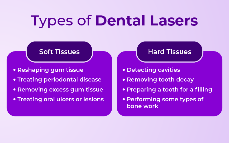 Types of Dental Lasers