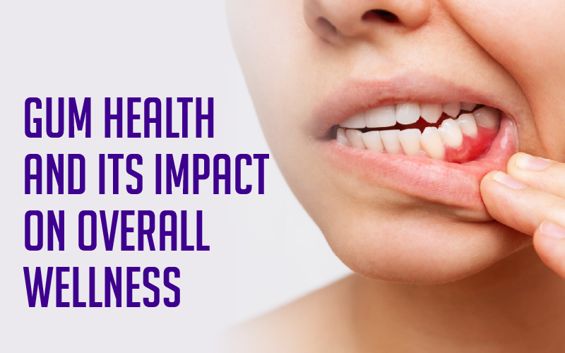 Gum Health and Its Impact on Overall Wellness