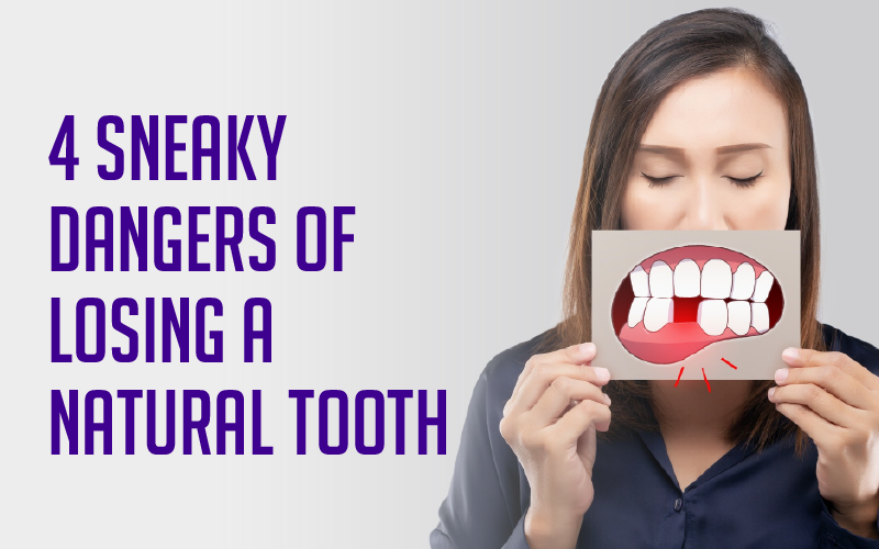4 Sneaky Dangers of Losing a Natural Tooth 
