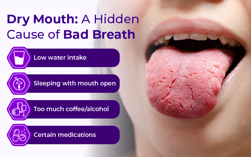 Your Mouth Might Be Too Dry
