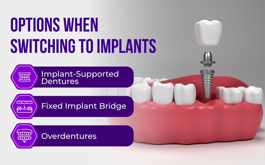 What Options You Actually Have When Switching From Dentures to Implants