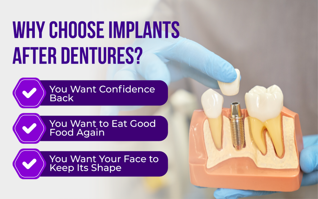Why You Might Want Implants After Wearing Dentures for Years