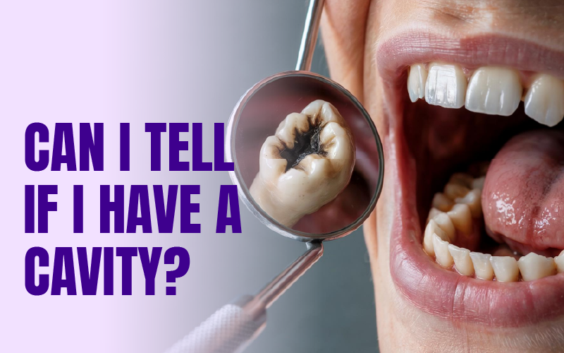 Can I Tell If I Have a Cavity?