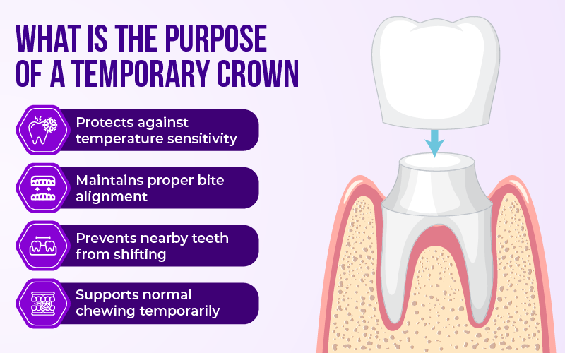 What Is the Purpose of a Temporary Crown