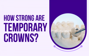 How Strong Are Temporary Crowns?