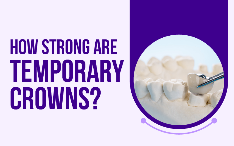 How Strong Are Temporary Crowns?