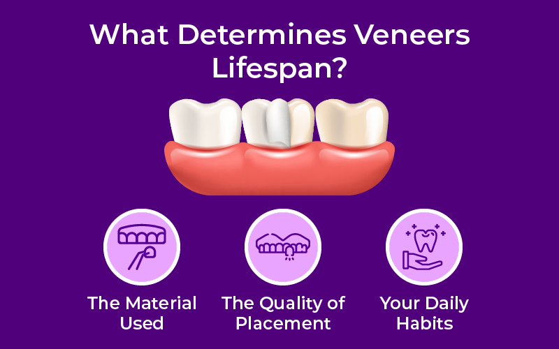 What Determines Veneers Lifespan?