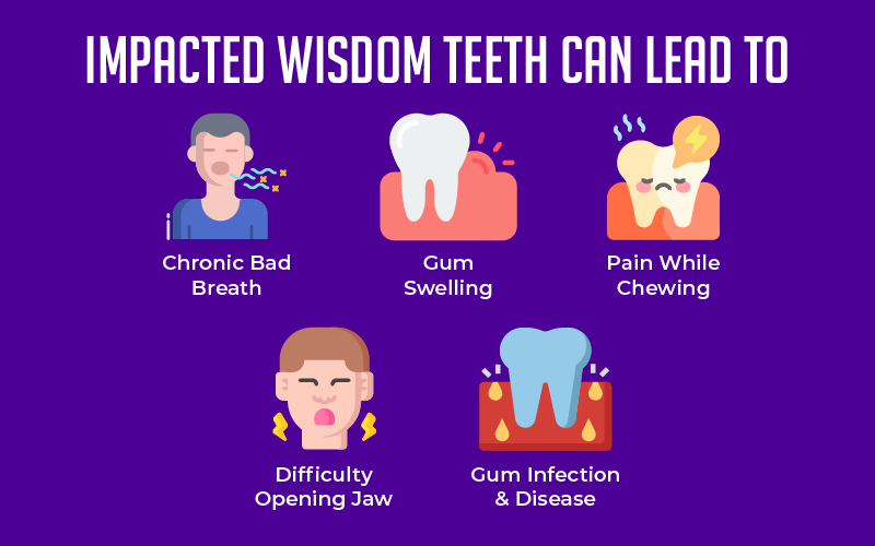 Impacted Wisdom Teeth Can Cause Bigger Problems