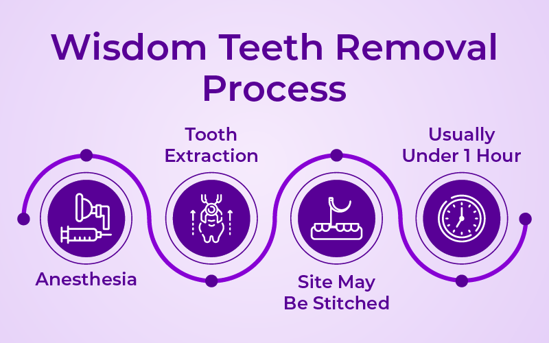 What Happens During Wisdom Teeth Removal?