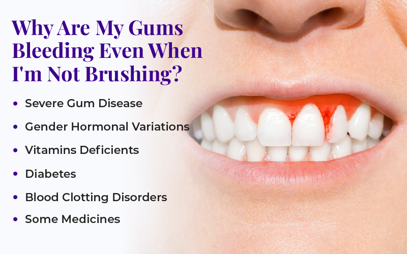 semaglutide bleeding gums What Are The Main Causes Of Gums? Causes of bleeding gums: A  Why Are my Gums Bleeding?