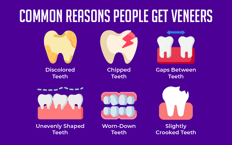 Common Reasons People Get Veneers