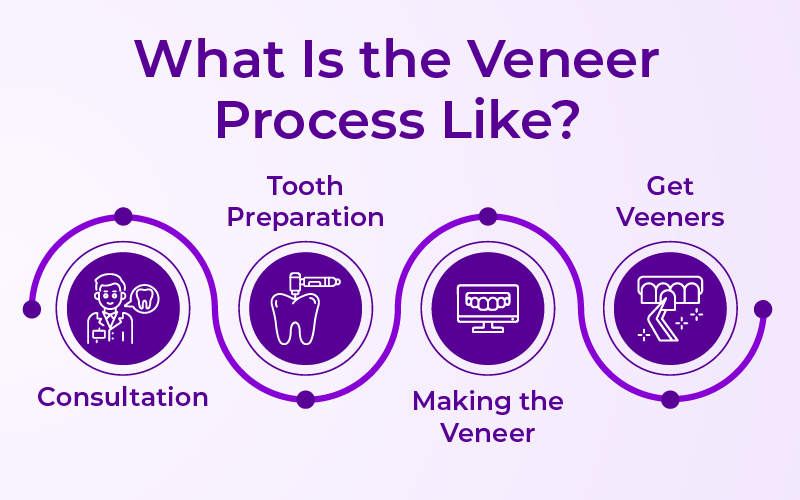 What Is the Veneer Process Like?
