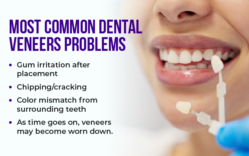 What Are the Most Common Dental Veneers Problems?