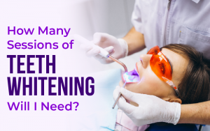 How Many Sessions of Teeth Whitening Will I Need?