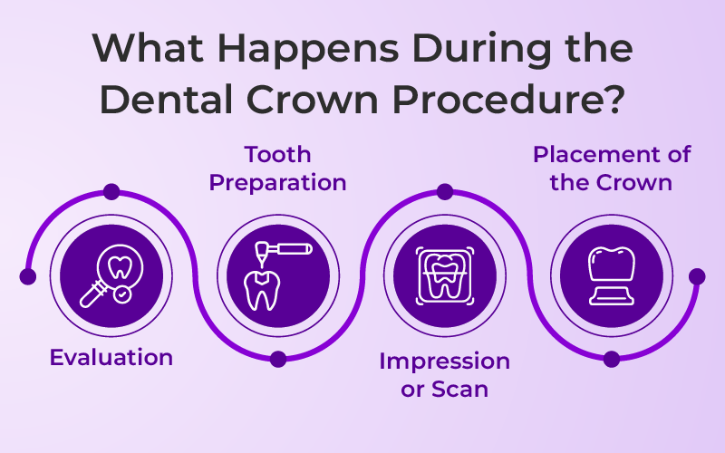 What Happens During the Dental Crown Procedure?