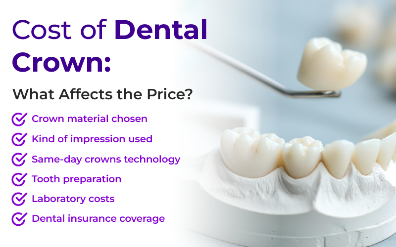 Cost of Dental Crown: What Affects the Price?