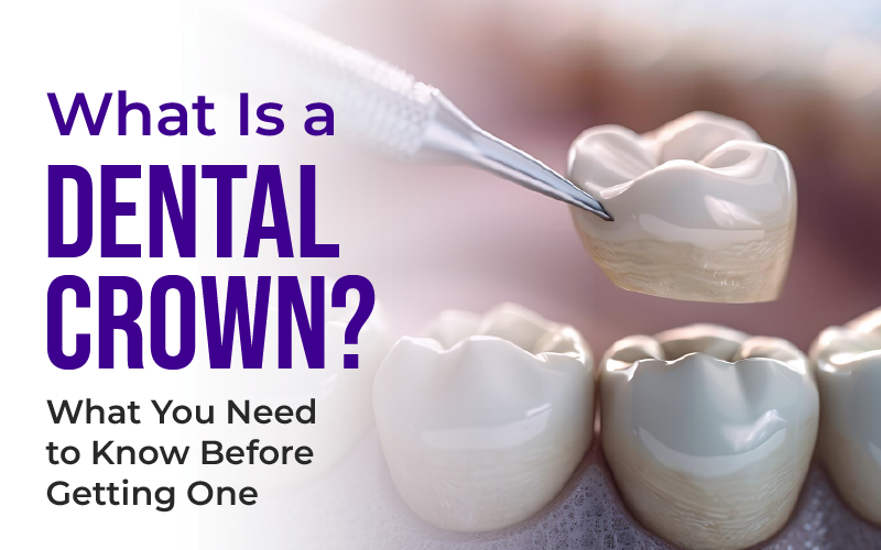 What Is a Dental Crown? What You Need to Know Before Getting One