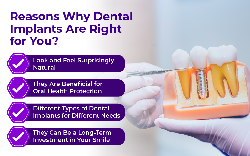 Reasons Why Dental Implants Are Right for You