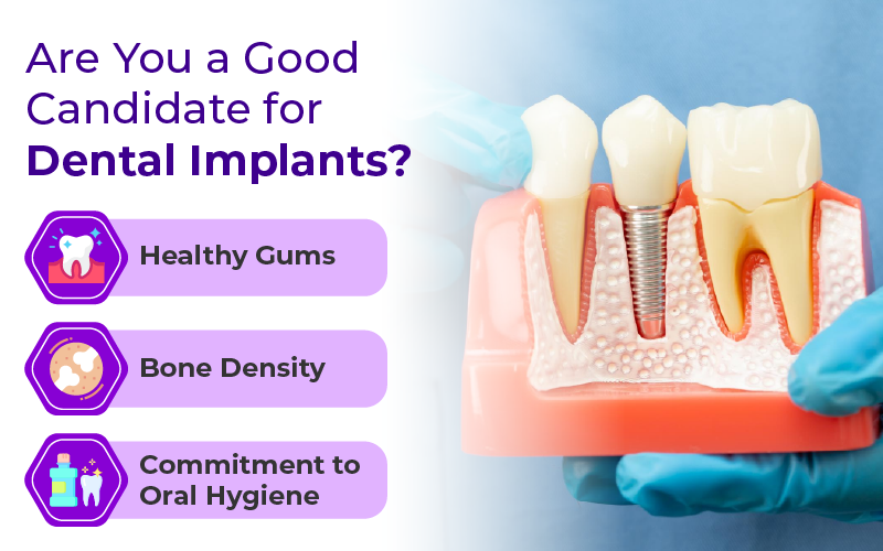Are You a Good Candidate for Dental Implants?