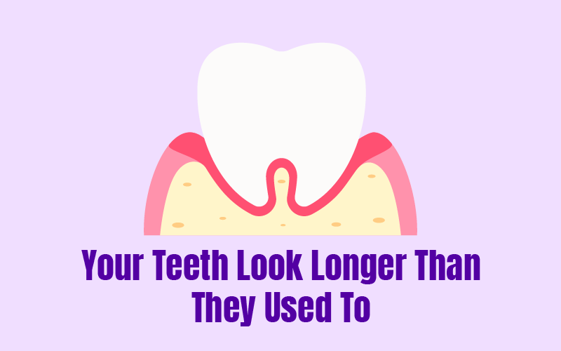 Your Teeth Look Longer Than They Used To