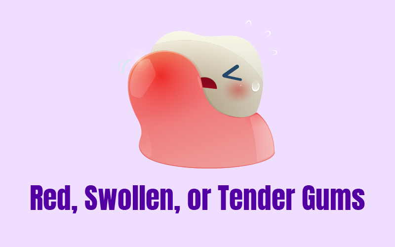 Red, Swollen, or Tender Gums