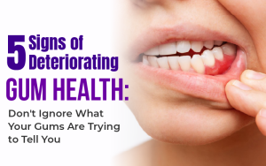 5 Signs of Deteriorating Gum Health: Don't Ignore What Your Gums Are Trying to Tell You
