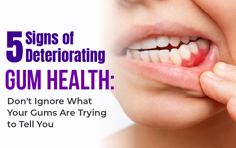 5 Signs of Deteriorating Gum Health: Don’t Ignore What Your Gums Are Trying to Tell You