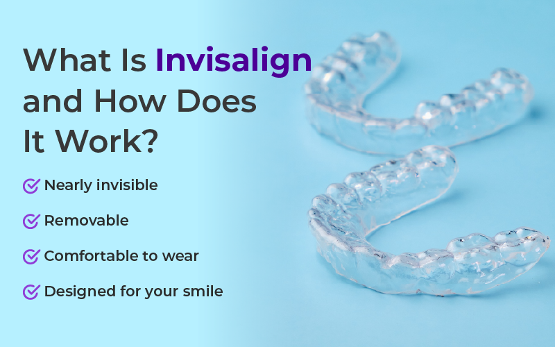 What Is Invisalign and How Does It Work?