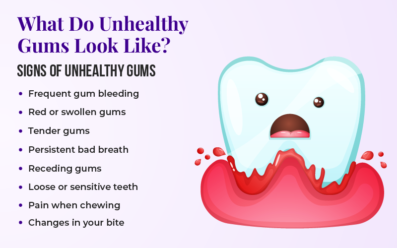 What Do Unhealthy Gums Look Like?